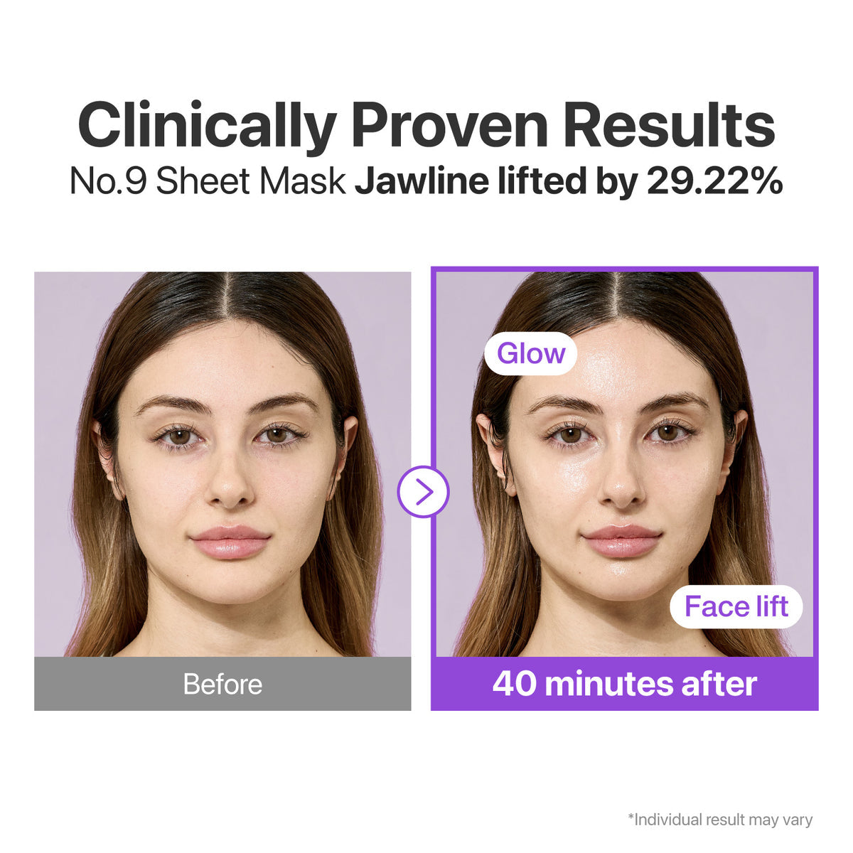 No.9 NAD+ BIO Lifting-sil Full Face Mask (4 Sheets + Lifting Band)