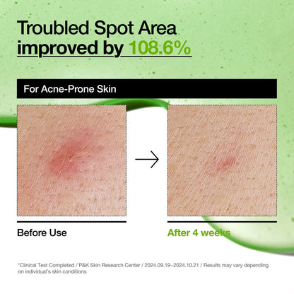 Anua Azelaic Acid 10+ Hyaluron